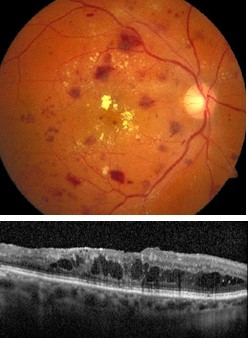 ibmt-ophthalmo-ai